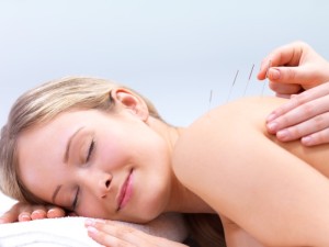 Acupunture for back pain relief